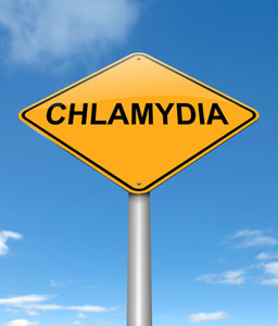 Chlamydien Infektion?